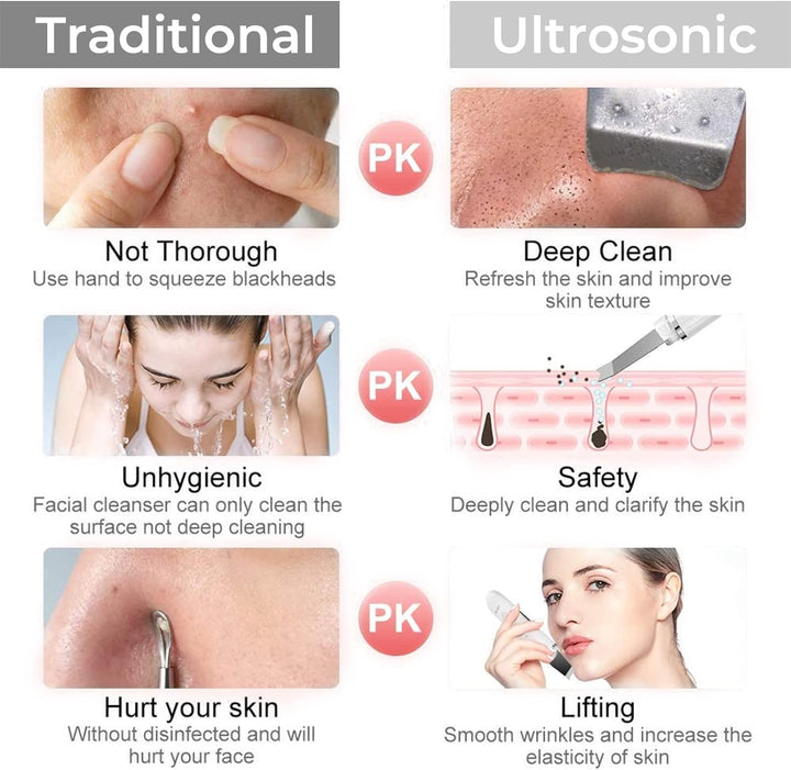 kin Scrubber, ANLAN Ultrasonic EMS Ion Exfoliating Device Face Cleanser and Blackhead Remover Pores Cleaning Wrinkle Remover Comedone Extractor Skin Care With 4 Modes USB Rechargeable